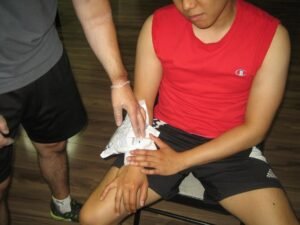 bruises treatment with First Aid Training Windsor